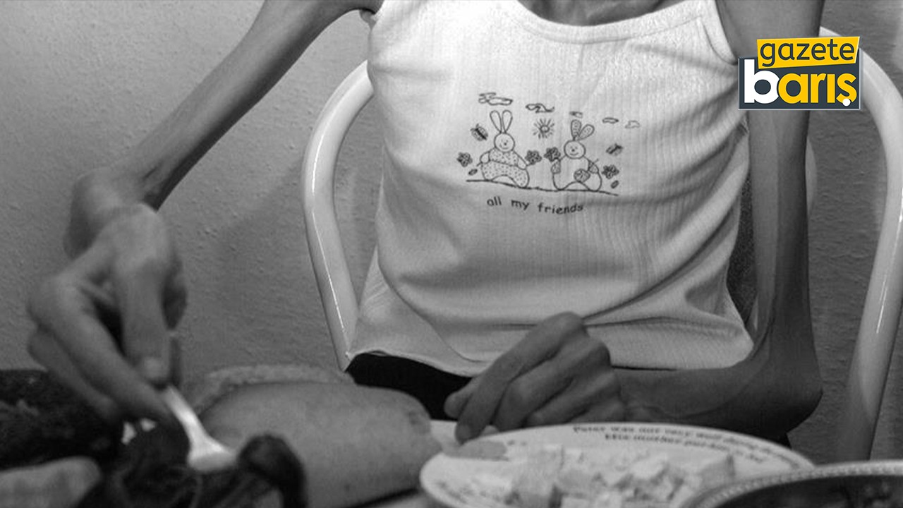 Uzman açıkladı: Yapay güzellik algısı yeme bozukluğu nedeni