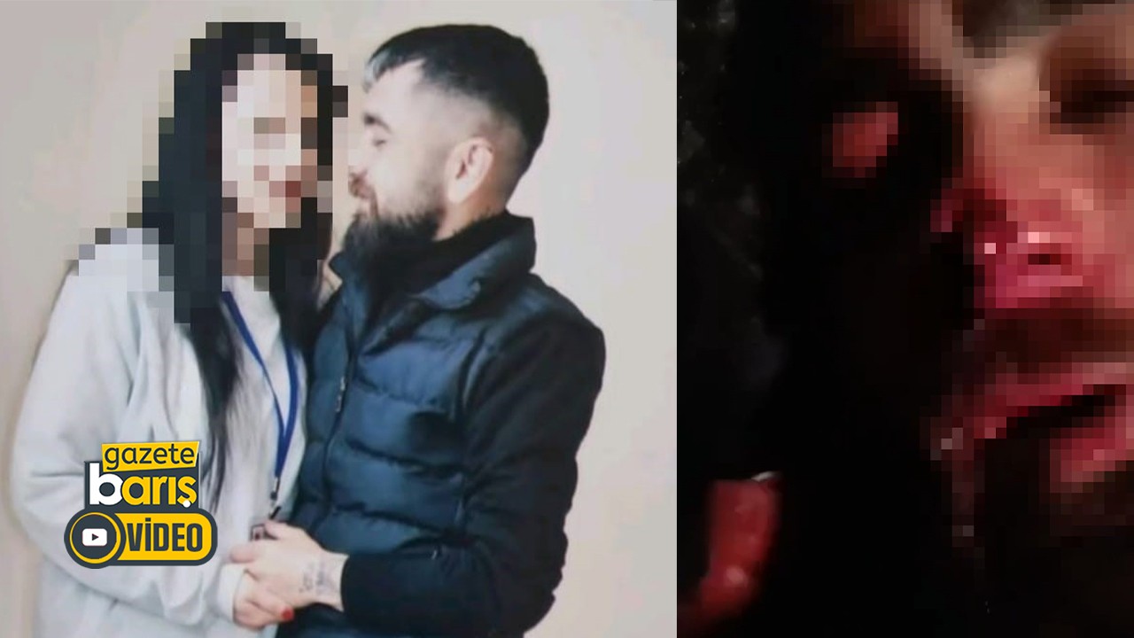 Türkiye’de akıl almaz işkence! Kardeşinin eski sevgilisinin burnunu ve kulağını yedi!
