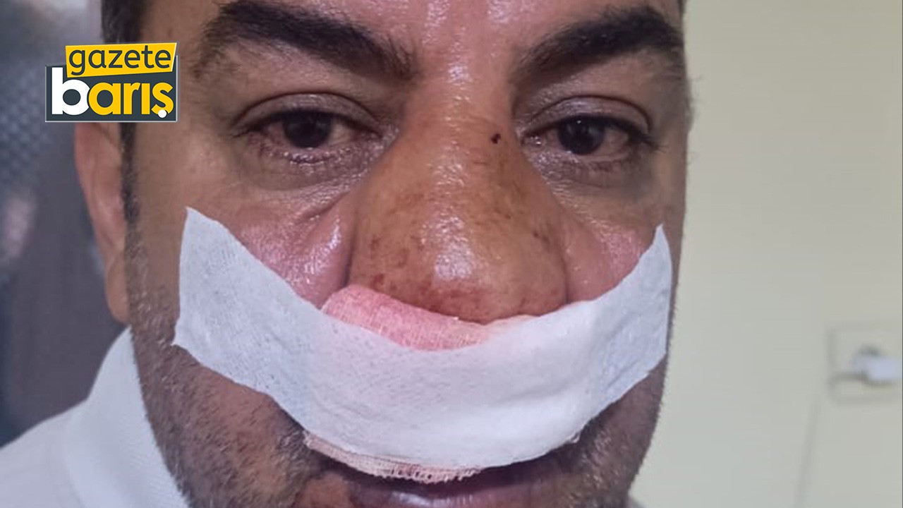 Kocaeli'de tur şoförünü darp eden 2 şahıs tutuklandı!