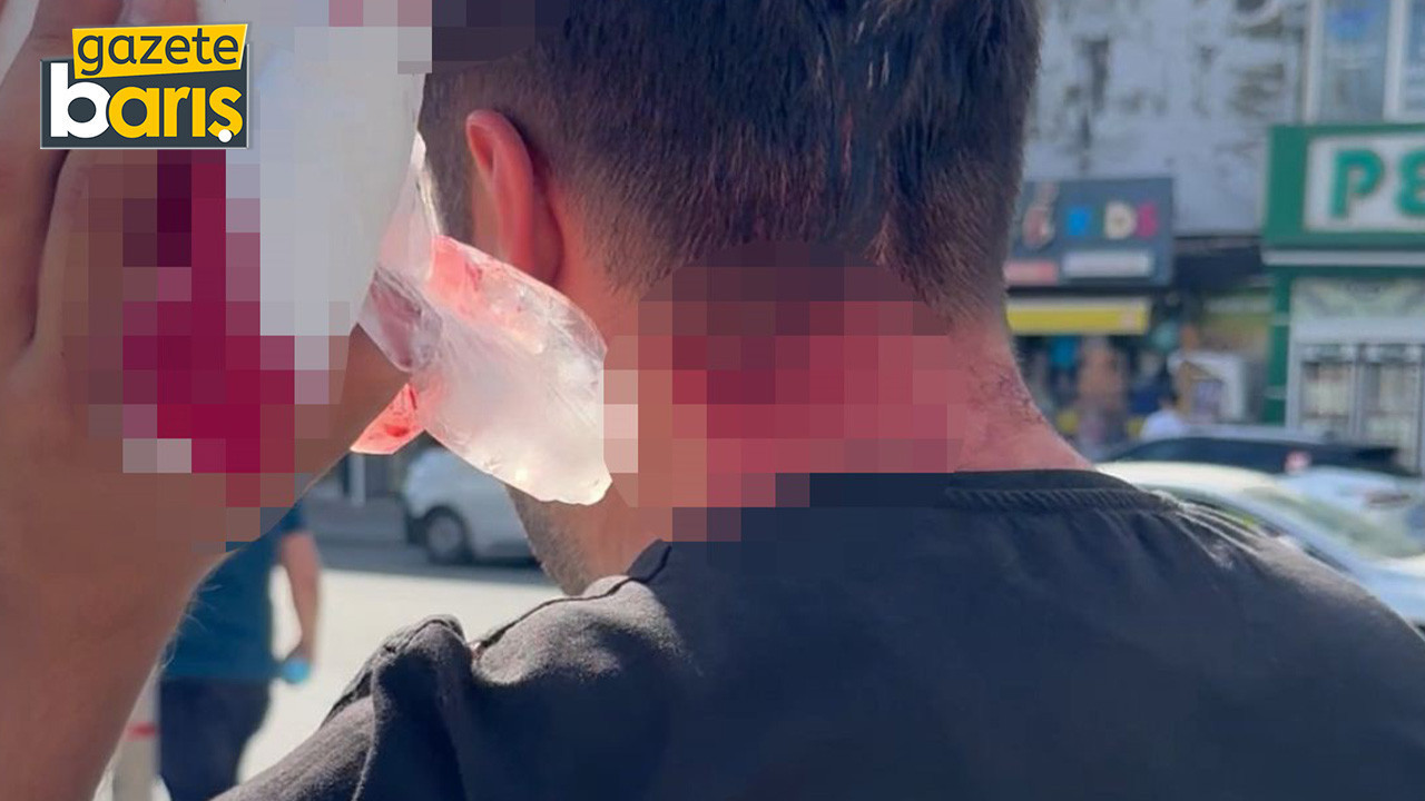 Vekilin cenazesinde kavga kanlı bitti