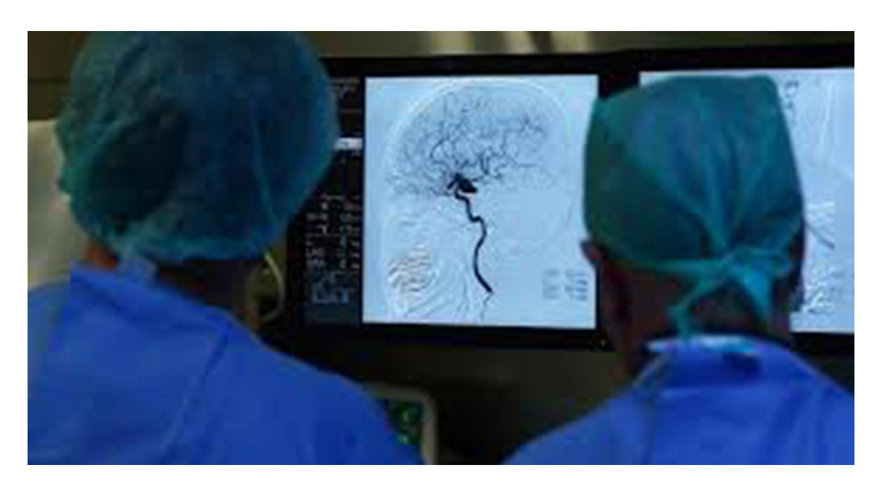 İnme vakalarının yüzde 17'si 50 yaş altında