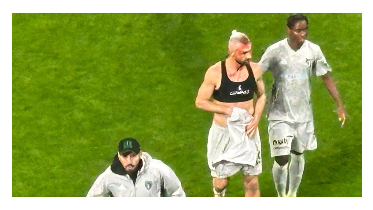 Serdar Dursun’un kafasına 12 dikiş atıldı