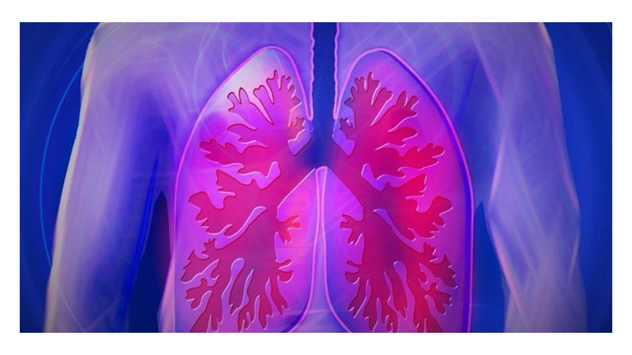 Son 5 yılda akciğer kanseri görülme sıklığı yüzde 15 arttı