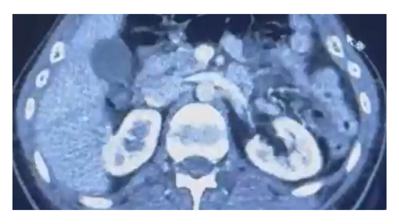 Uyuşturucuyu ülkeye bakın nerelerinde getirdiler