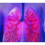 Akciğer sağlığı için önemli 10 gıda