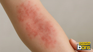 Vücut dönüp kendine saldırıyor: Bu hastalık organları vuruyor