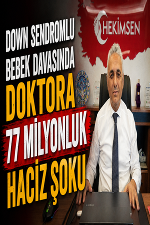 Down sendromlu bebek davasında doktora 77 milyonluk haciz şoku