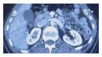 Uyuşturucuyu ülkeye bakın nerelerinde getirdiler