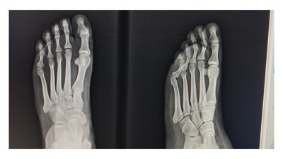 4 bin TL’lik iddia! Acil serviste kim acil?