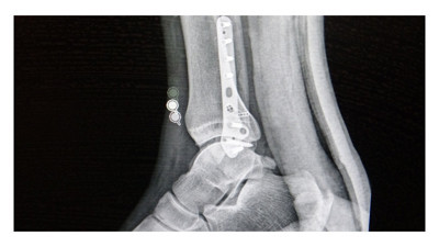 Spor yapanlar dikkat! Uzman isimden uyarı