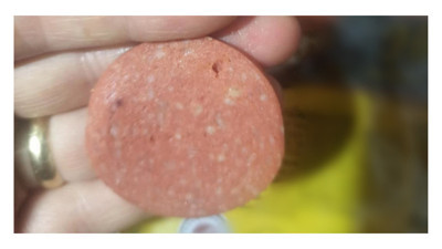 Sucuktan çıkan kemiği şikayet etti