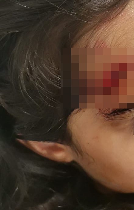 Kocaeli’de 8 yaşındaki çocuğuna köpek saldırısı: Baba isyan etti!