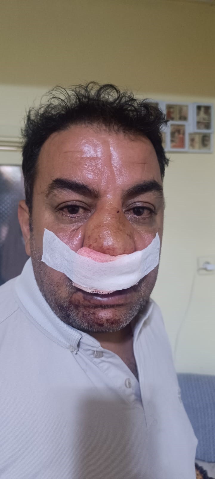 Kocaeli’de skandal: Fahiş fotoğraf ücreti tartışması kanlı bitti!