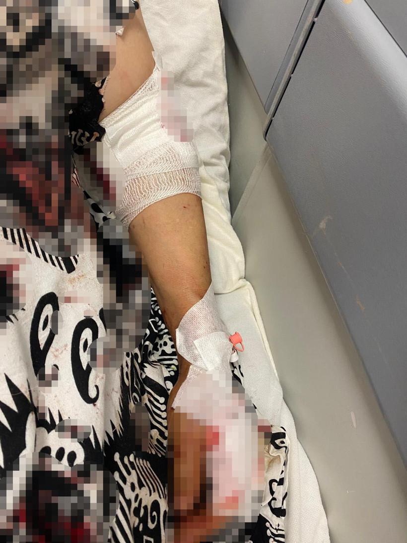 Kocaeli'de abdest almak için bahçeye çıkan kadına köpekler saldırdı