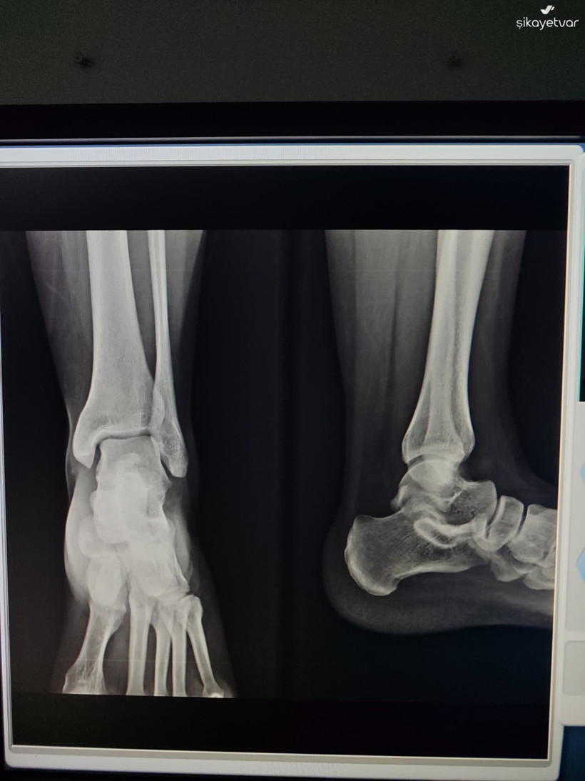 4 bin TL’lik iddia! Acil serviste kim acil?