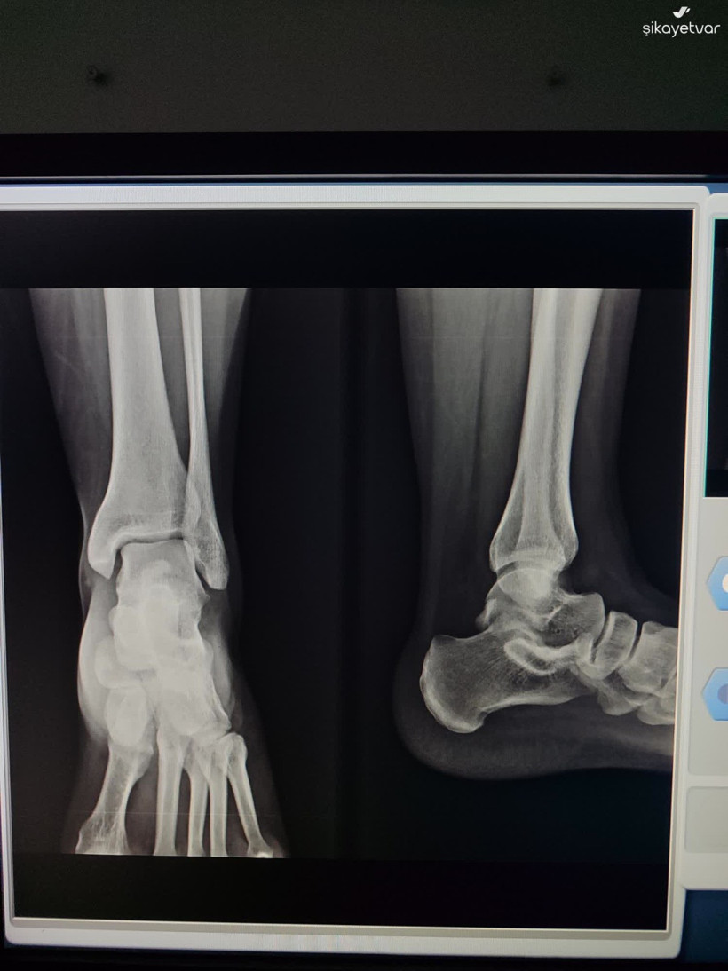 4 bin TL’lik iddia! Acil serviste kim acil?