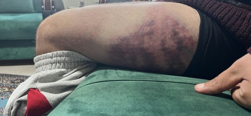 Otizmli genci "odunluğa baktı" diye darbetmişti, O fırın çalışanı tutuklandı