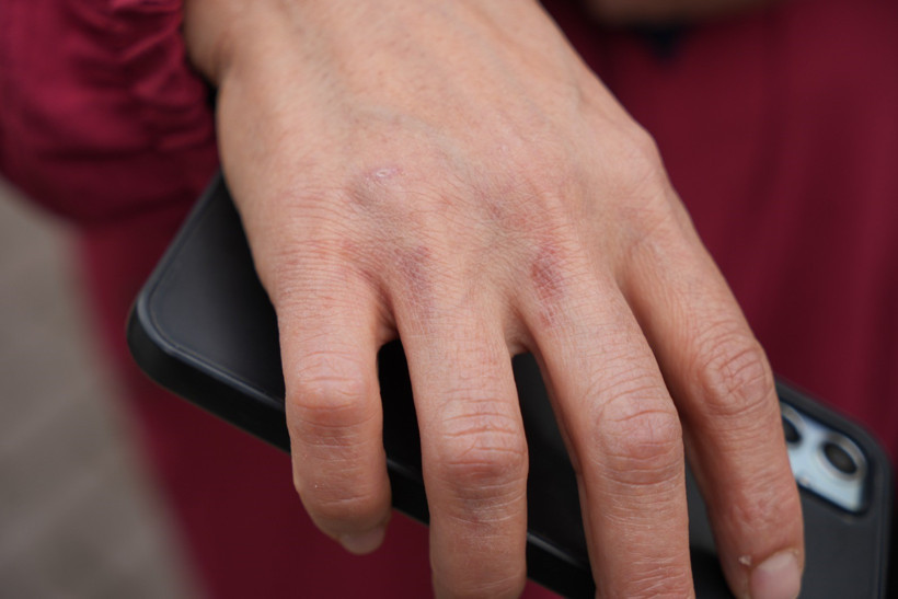 Dilovası'ndaki cehennemden sağ çıkmıştı! O anları böyle anlattı