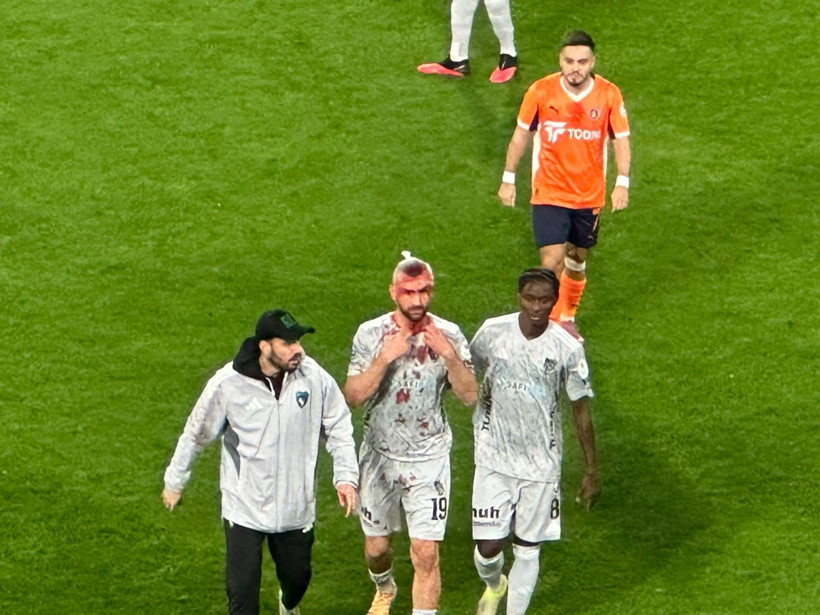 Serdar Dursun kafasından darbe aldı: Oyuna devam ediyor