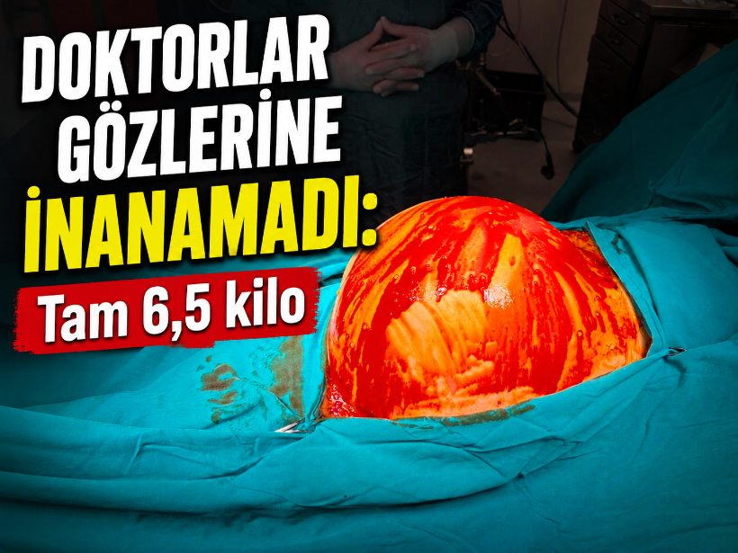 Doktorlar gözlerine inanamadı: Tam 6,5 kilo