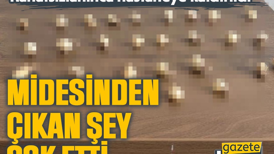 Rahatsızlanınca hastaneye kaldırılan şahsın midesinden çıkan şey şok etti
