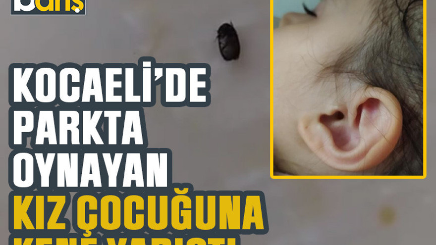 Kocaeli’de parkta oynayan kız çocuğuna kene yapıştı