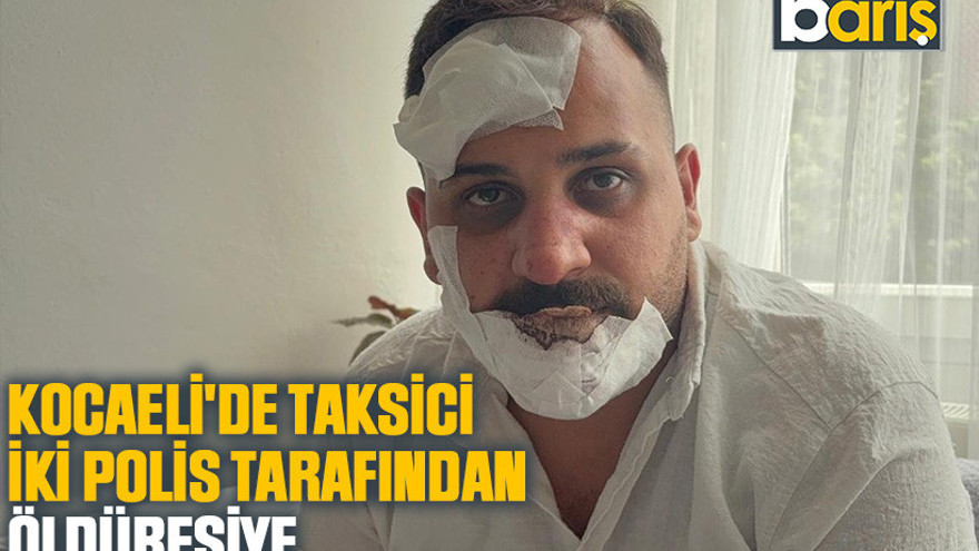 Kocaeli'de taksici iki polis tarafından öldüresiye dövüldüğünü iddia etti